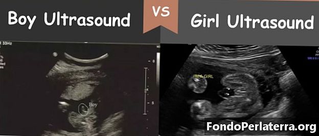 Boy Ultrasound kumpara sa Girl Ultrasound