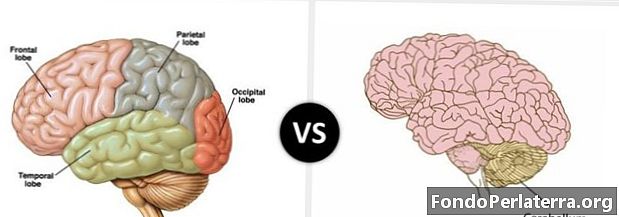 Cerebro contra cerebelo