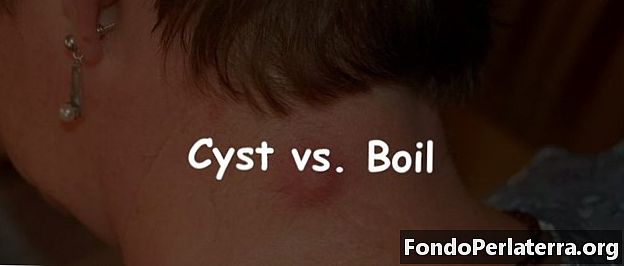 Cysta vs. Boil