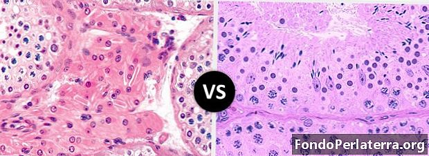 Leydig's Cells vs. Sertoli Cells
