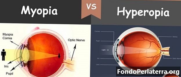 Miopia vs Ipermetropia