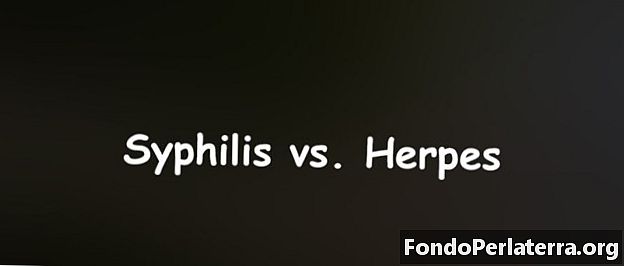 Sifilis vs. Herpes