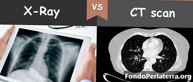 Röntgenstrålar kontra CT-skanning
