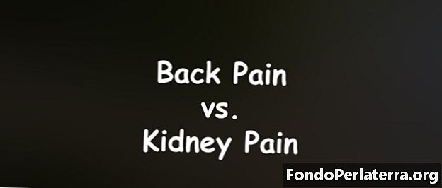 Back Pain vs. Kidney Pain