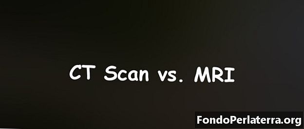 CT Scan vs. MRI