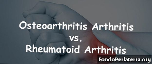 Osteoartritis artritis v primerjavi z revmatoidnim artritisom