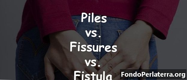 Vaiad vs lõhed vs fistula