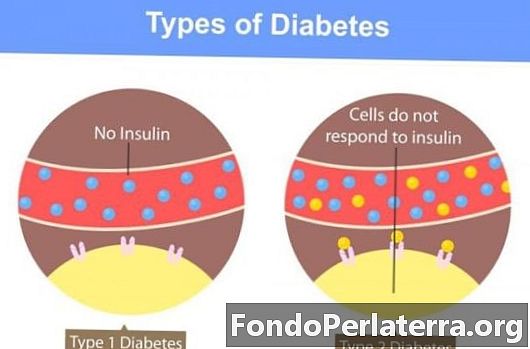 Diabetes tipo 1 versus diabetes tipo 2