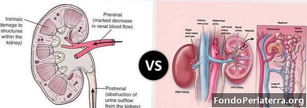 Akutes Nierenversagen vs. chronisches Nierenversagen