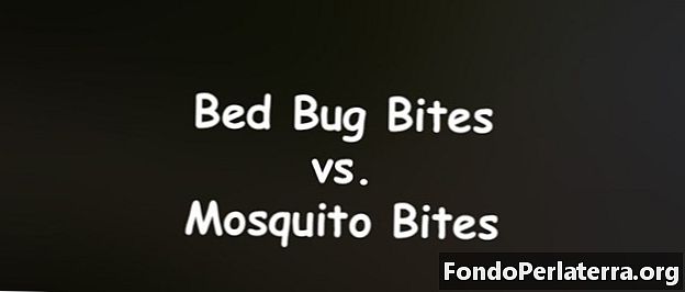 Bed Bug Bites kumpara sa Mga Kagat ng lamok